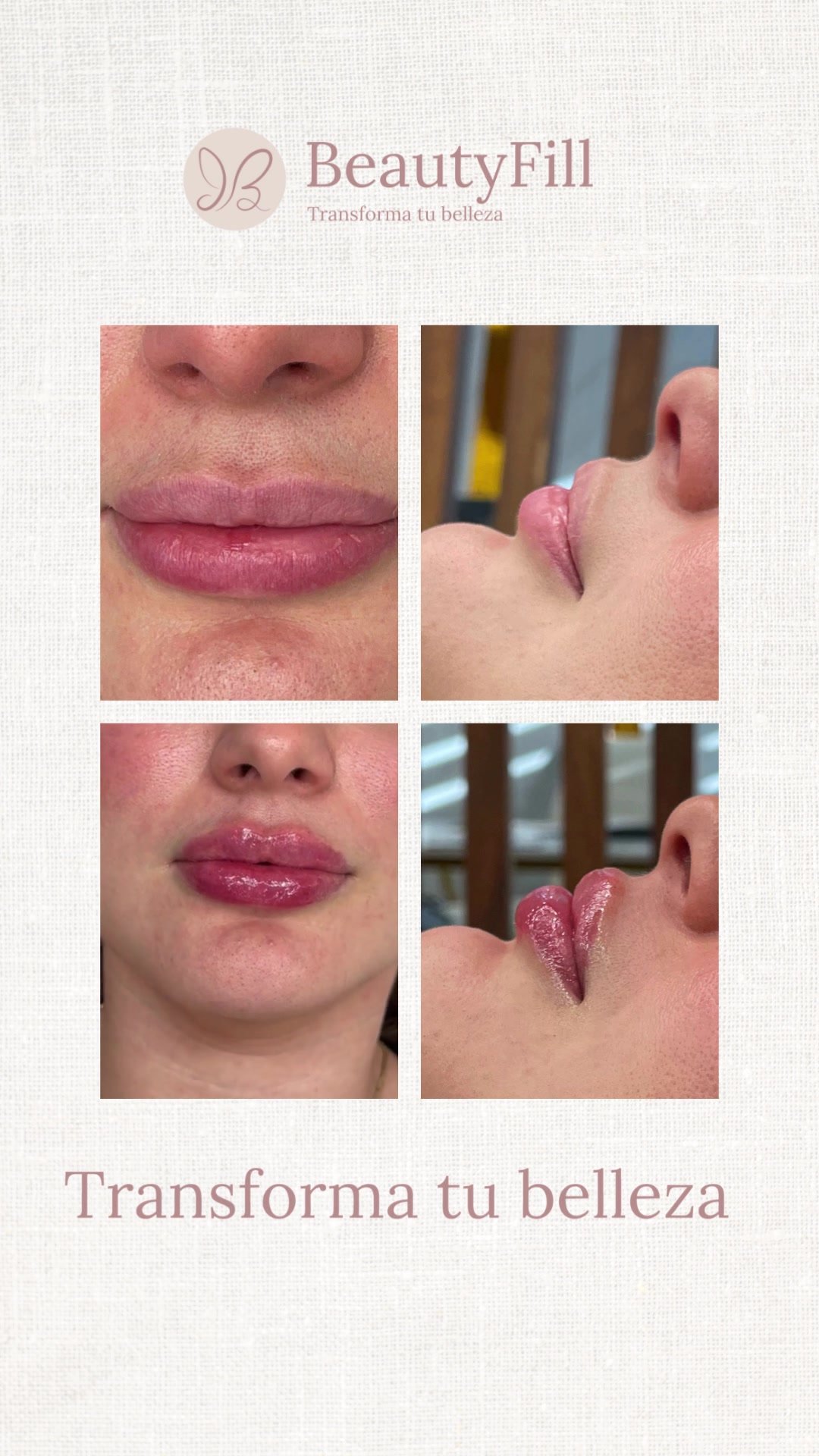Antes tratamiento facial